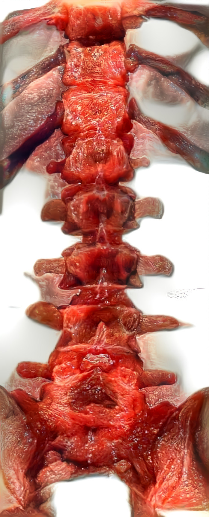 spine x-ray retextured with meat