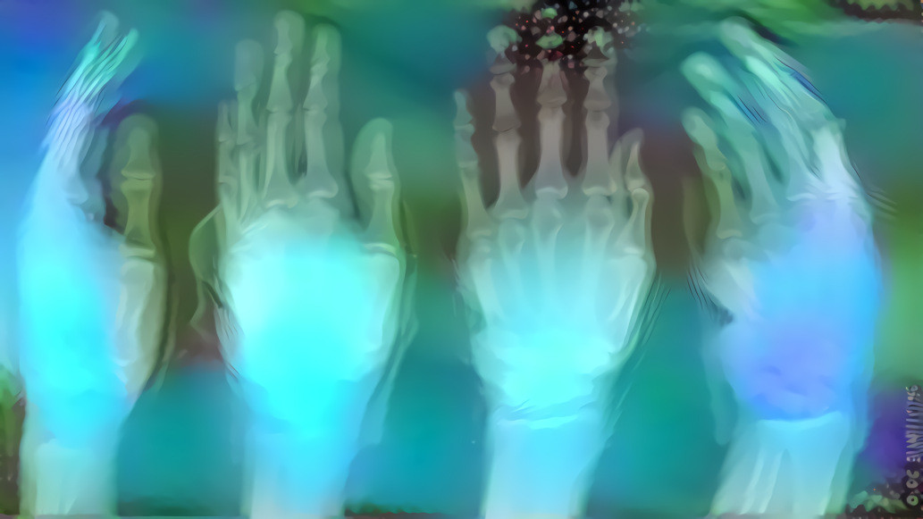 Hand x-rays - Filter is one of my Frax creations.